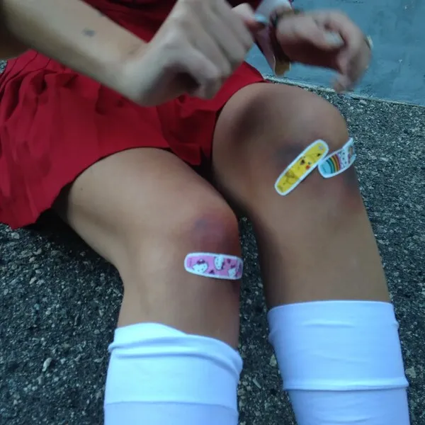 Bruise のサムネイル